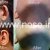 Ear Plastic Surgery by Dr. Mohsen Naraghi